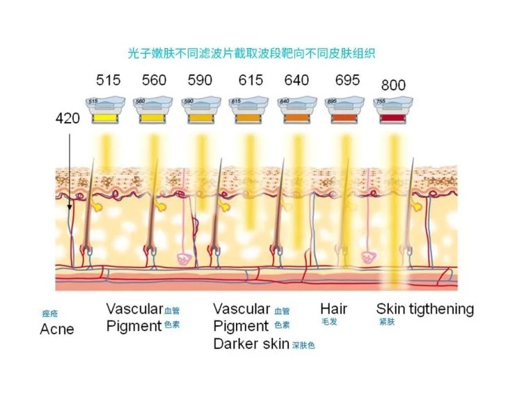 五大光子嫩膚技術(shù)（IPL、DPL、OPT、APT、BBL）及濾光片區(qū)別