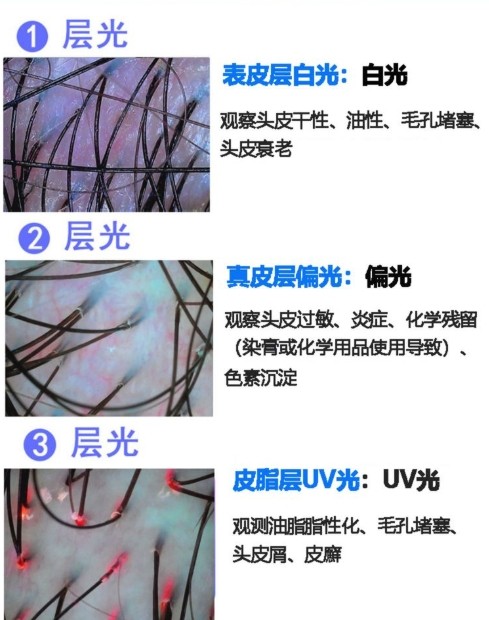 不同光對(duì)頭發(fā)的觀測效果