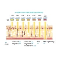 五大光子嫩膚技術(shù)（IPL、DPL、OPT、APT、BBL）及濾光片區(qū)別